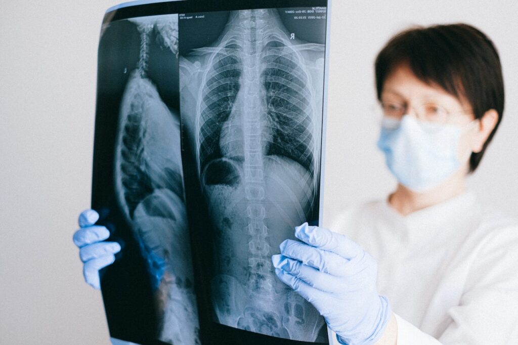 What Does a Pulmonologist Do? Exploring the Role of Lung Specialists